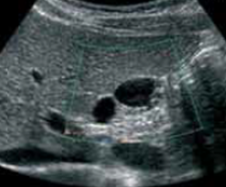 ULTRA SONOGRAPHY